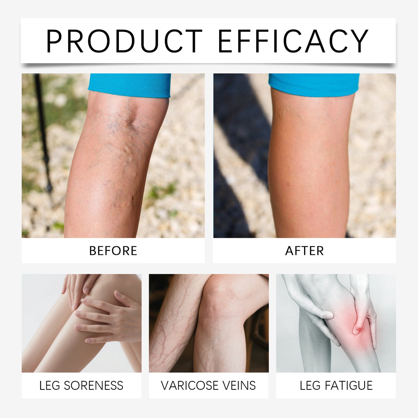 VeinTarget Microneedle Patch