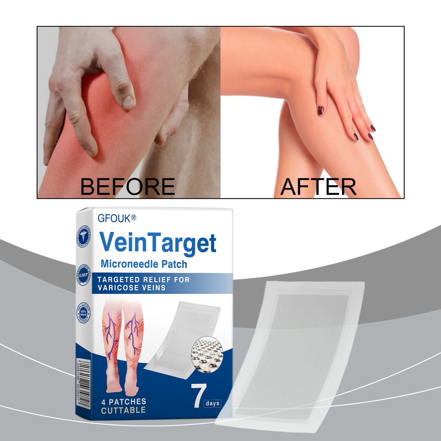 VeinTarget Microneedle Patch